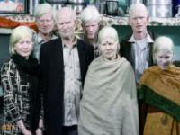 Największa rodzina albinosów