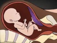 Aborcja Chirurgiczna 2 trymestr ciąży - Nawrócony Aborcjonista mówi jak wygląda Aborcja
