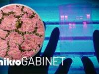 Biofilm - sposób bakterii na uniknięcie antybiotyków | mikroGABINET