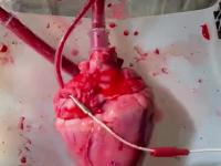 Ludzkie serce podczas etapu transplantacji