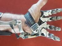 Niesamowita mechaniczna proteza palców wykonana we własnym warsztacie