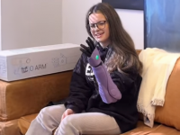 15-letnia dziewczyna otrzymała bioniczną rękę